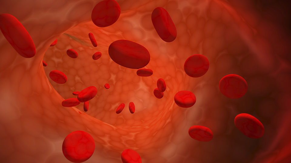 Dysfunctional red blood cells contribute to the blood vessel injuries common in severe COVID-19, according to laboratory studies that also may suggest a way to treat the problem.