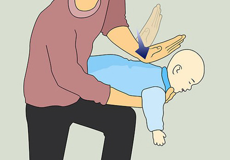 Vỗ lưng khi trẻ bị hóc dị vật là một cách sơ cứu hiệu quả. (Ảnh minh họa, nguồn: internet)