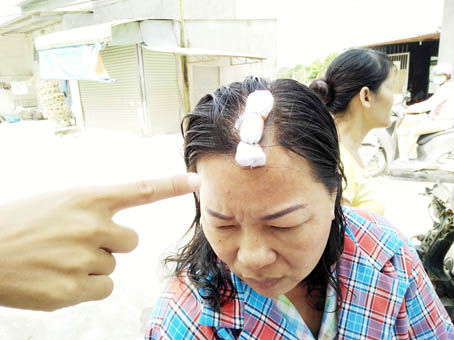 Bà Nguyễn Thị Kim Trang còn bị ông Hào đánh vào đầu gây thương tích.
