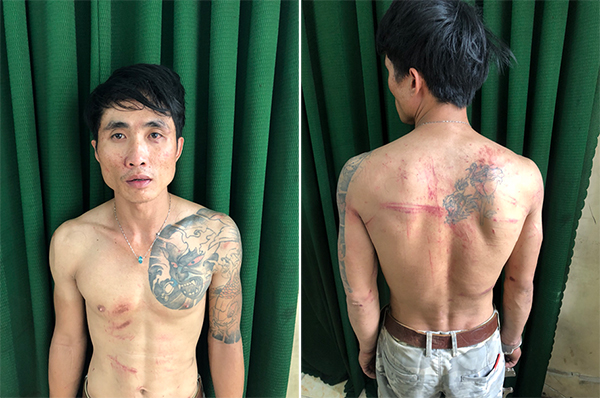 Hình xăm trên ngực và lưng của Nguyễn Lâm Giang đã tố cáo hành vi trộm cắp của đối tượng.