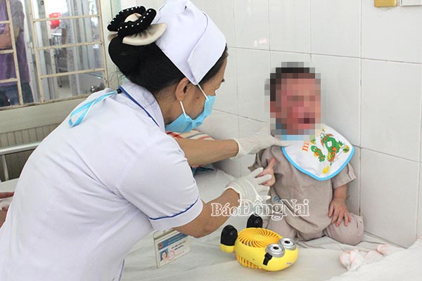 Trẻ bị bỏng đang được chăm sóc tại Bệnh viện nhi đồng Đồng Nai