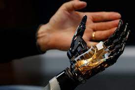 COVVI Group CEO Simon Pollard holds the bionic hand developed by COVVI, at Quayside Business Park in Leeds, Britain August 11, 2022. 